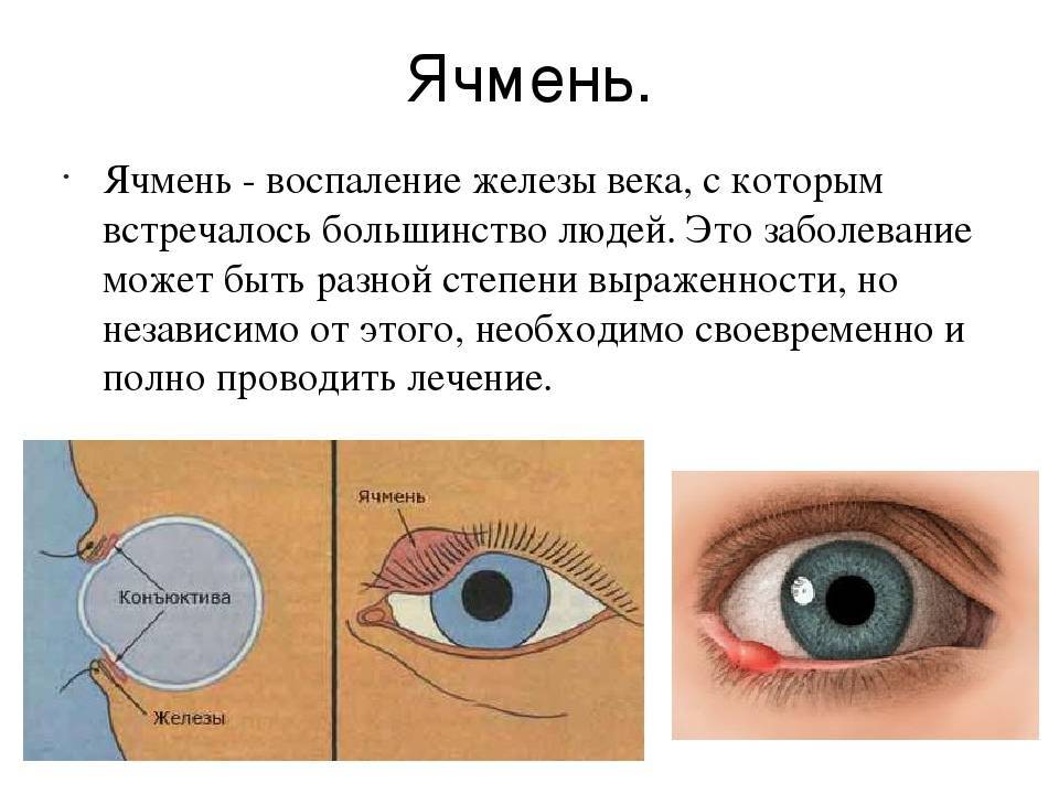 Лактационный мастит при грудном вскармливании: причины, симптомы и лечение