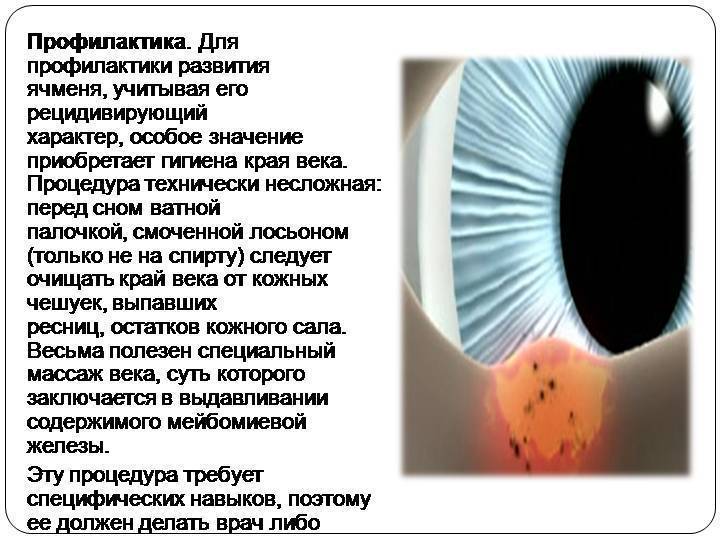 Что такое ячмень и 6 способов его лечения у детей