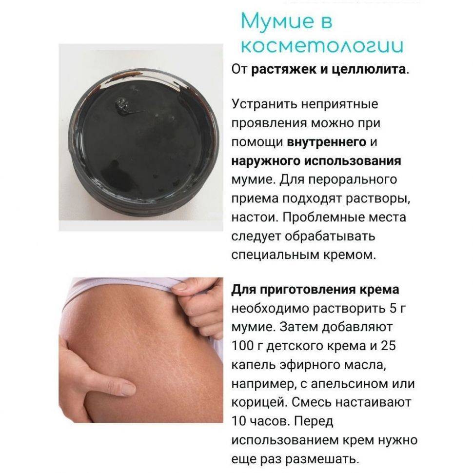 Как избавиться от растяжек после родов