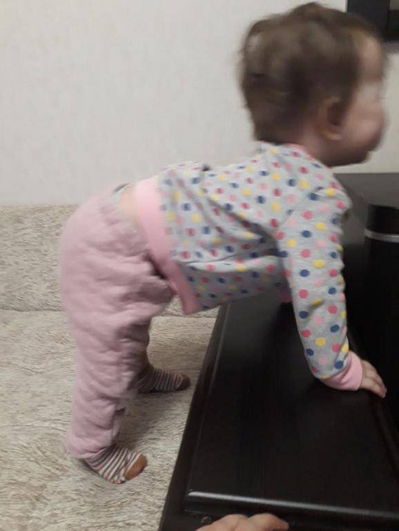 Задержка моторного развития
