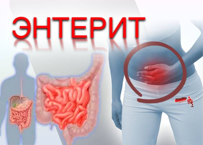 Педиатр подозревает у девочки 2,5 года хронический энтерит. возбудитель не установлен. куда бежать? - я happy mama