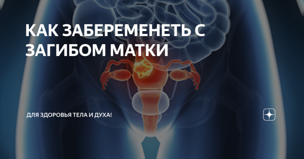 Совместимы ли загиб матки и беременность?