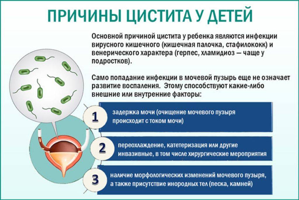 Цистит у детей - симптомы болезни, профилактика и лечение цистита у детей, причины заболевания и его диагностика на eurolab