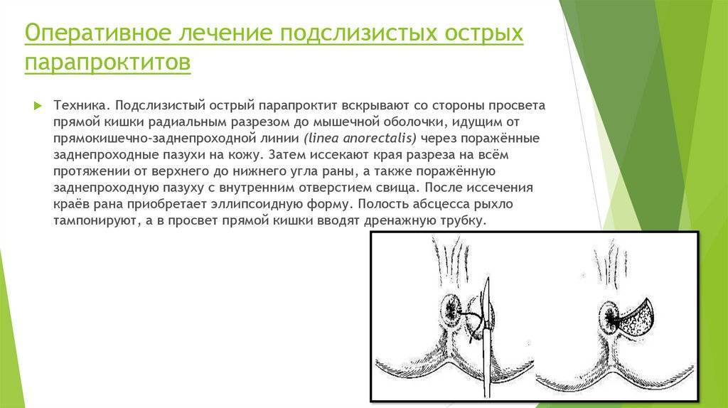 Парапроктит у детей, грудничков, новорожденных младенцев (до года) - причины, симптомы, лечение у малышей