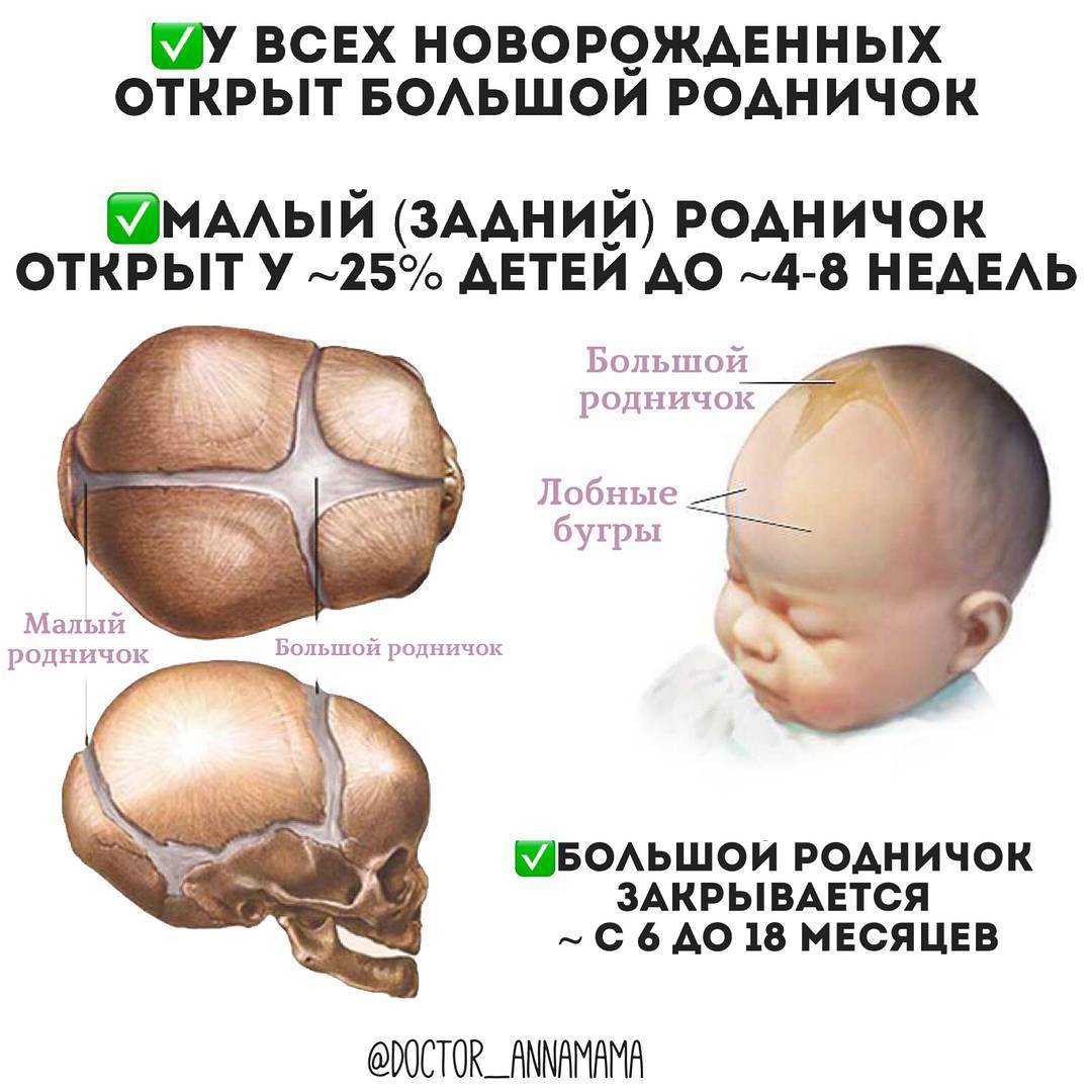 Родничок у новорожденных: нормы и отклонения