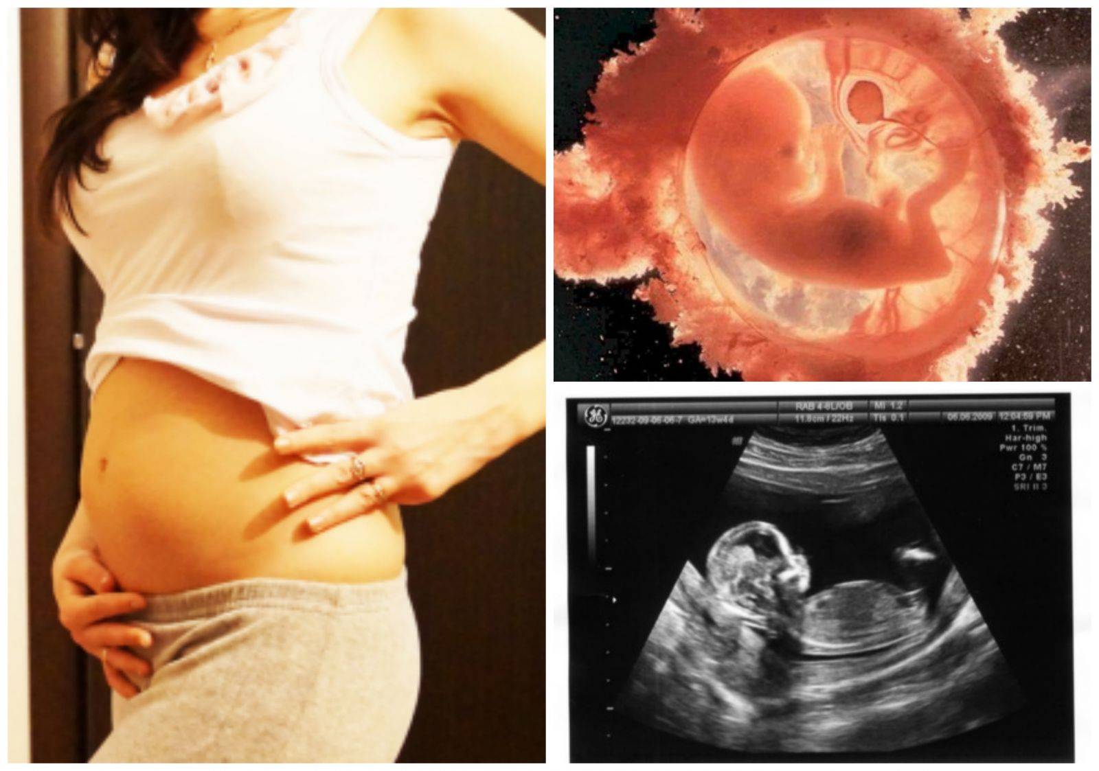 12 неделя беременности -первый скрининг и узи. нормы развития плода и расшифровка