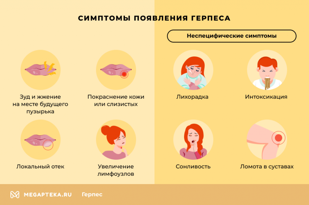 Герпес на губах при беременности