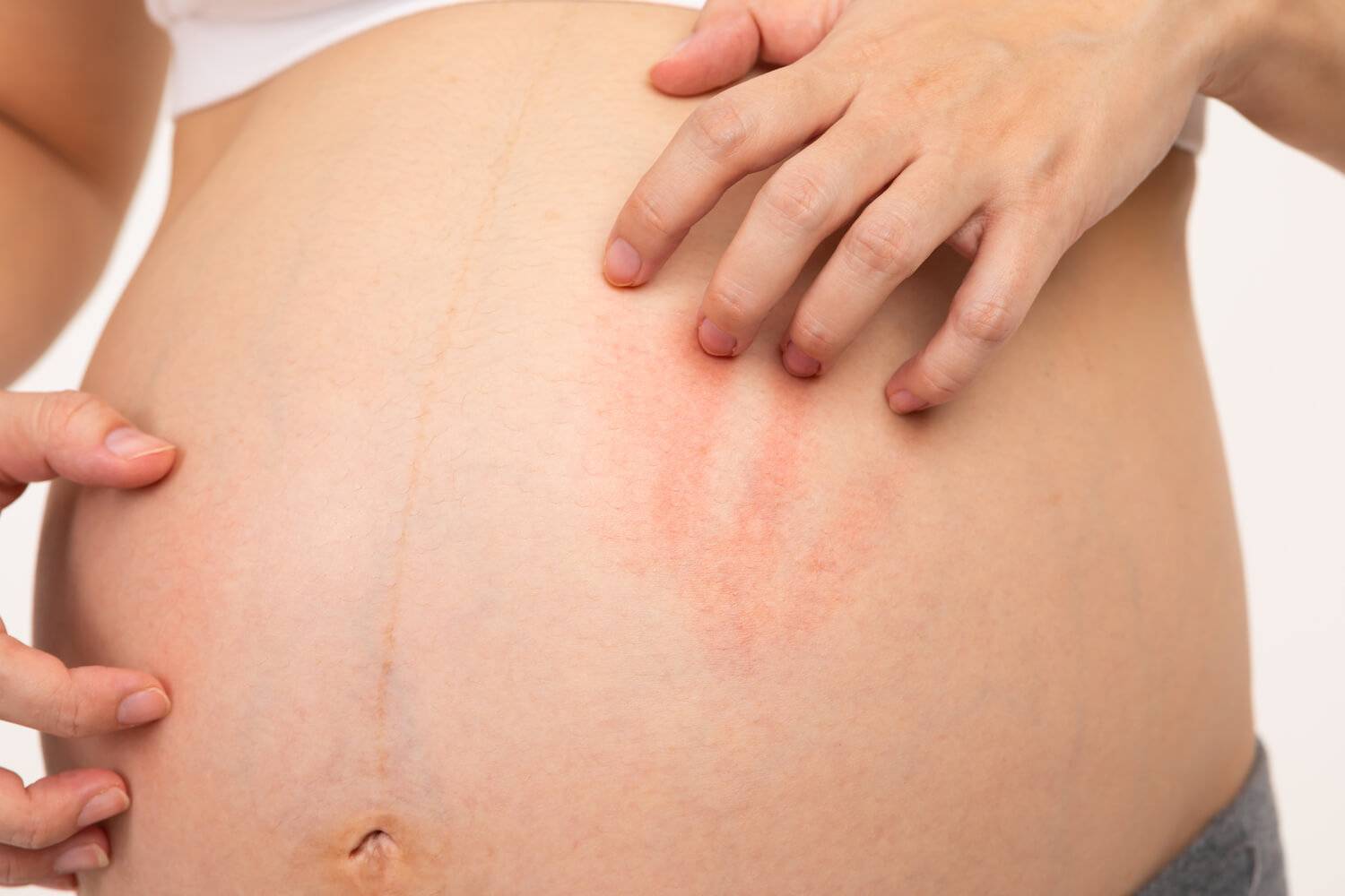грудь во время беременности красная чешется фото 102