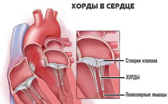 Дополнительная хорда в сердце: что это такое у ребенка, симптомы и лечение