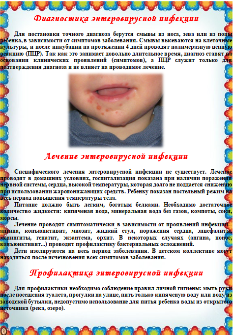 Сыпь На Небе У Ребенка Фото