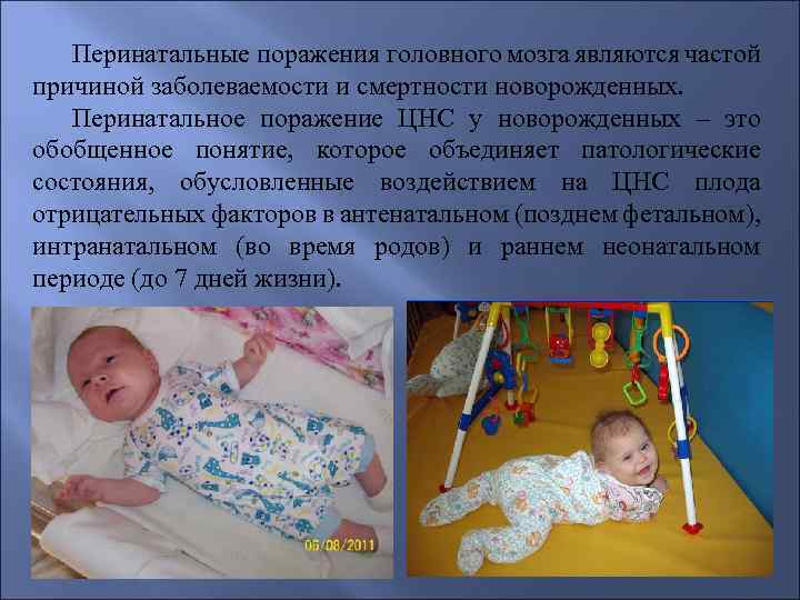 Гипоксически-ишемическое поражение цнс