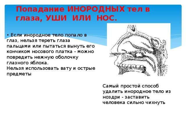 Попадание инородного тела в дыхательные пути ребенка, жкт, глаз, ухо или под кожу