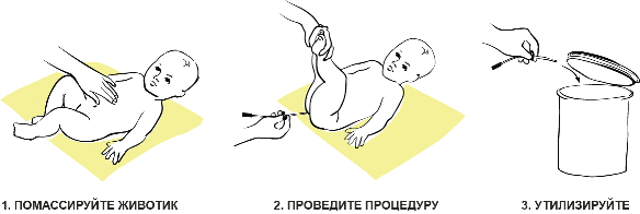 Можно делать клизму новорожденному. Постановка газоотводной трубки новорожденному ребенку. Введение газоотводной трубки новорожденному. Газоотводная трубка детям алгоритм. Газоотводная трубка новорожденному алгоритм.