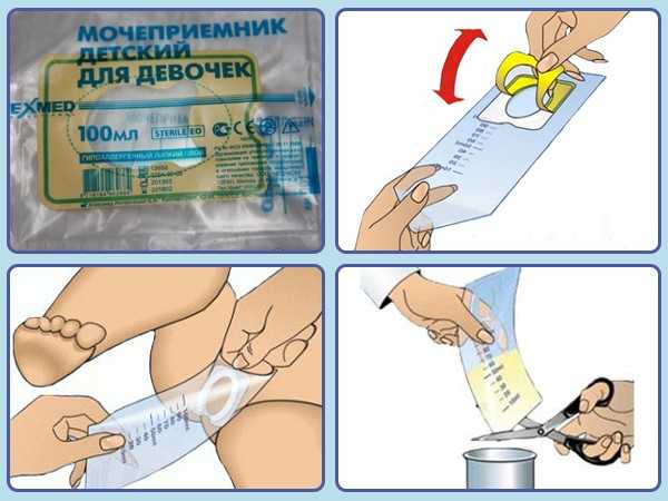 Особенности сбора мочи у девочек и мальчиков грудного возраста