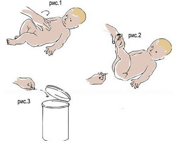 Как пользоваться газоотводной трубкой для новорожденных: инструкция для мам