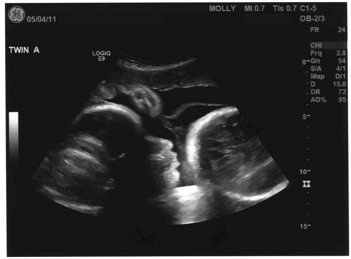 Узи 29 недель. УЗИ мальчик 36 недель беременности. УЗИ ребенка на 36 неделе беременности. Снимок УЗИ 32 недели беременности. Снимки УЗИ В 36 недель беременности.