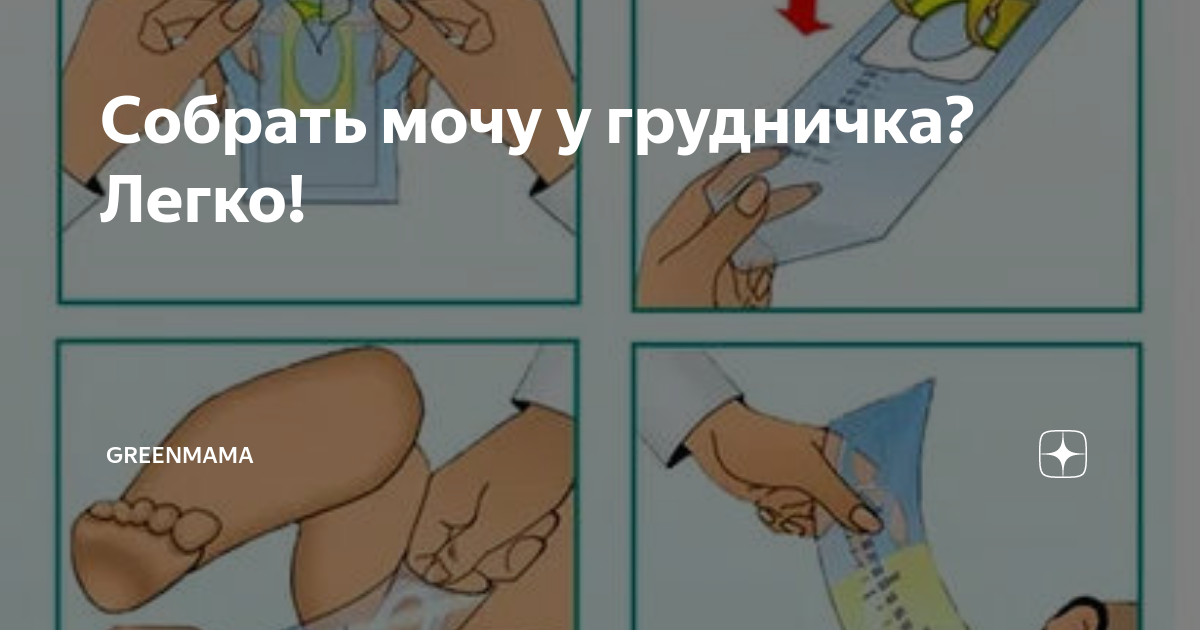 Как собрать новорожденного. Как собрать мочу у новорожденного. Пакет для забора мочи у младенцев.