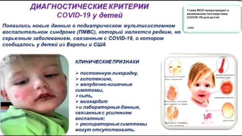 Вирус коксаки у детей: основные симптомы - вирусные болезни