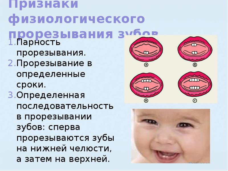 Температура при прорезывании зубов: 2 причины, когда сбивать, 2 разрешённых препарата