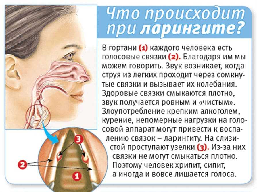Осип голос у грудничка: что делать