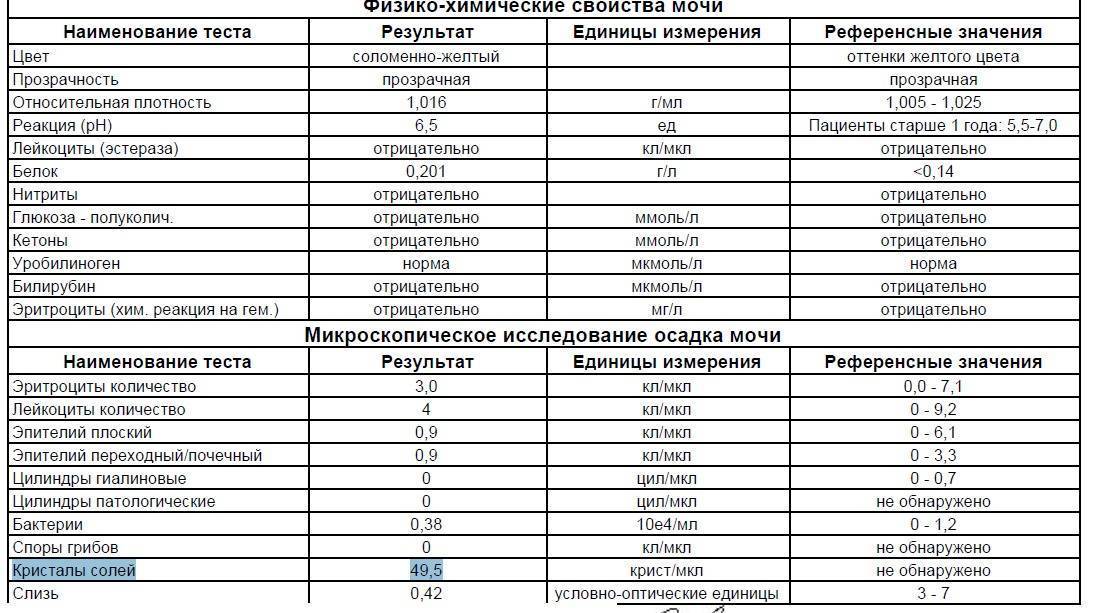 Соли в моче у ребенка: нормы и причины превышения