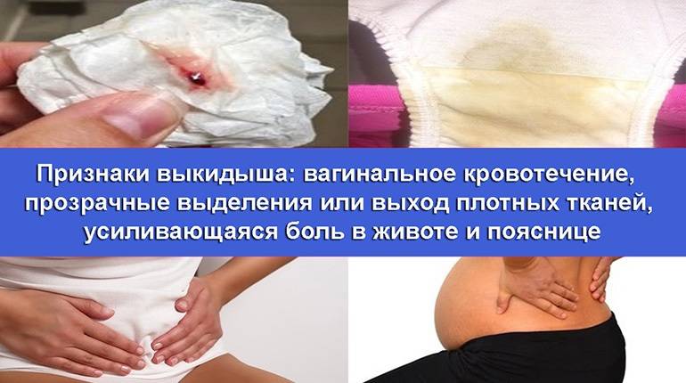 Выделения при беременности на ранних сроках