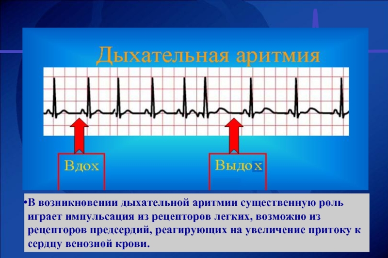 Дыхательная аритмия у детей: причины, симптомы, лечение, диагностика, коррекция образа жизни