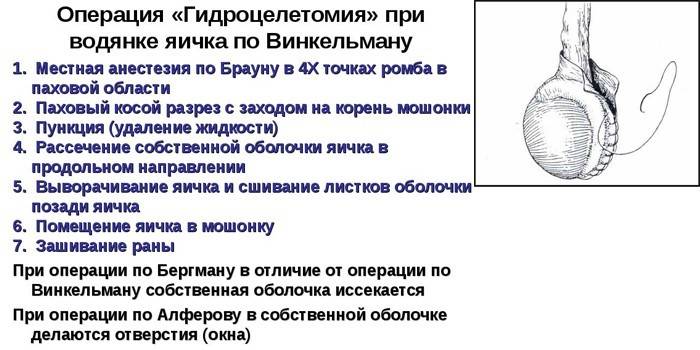 Что такое варикоцеле: симптомы и лечение у детей и подростков, показания к операции