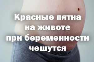 Почему у беременных чешется тело и как избавиться от зуда?