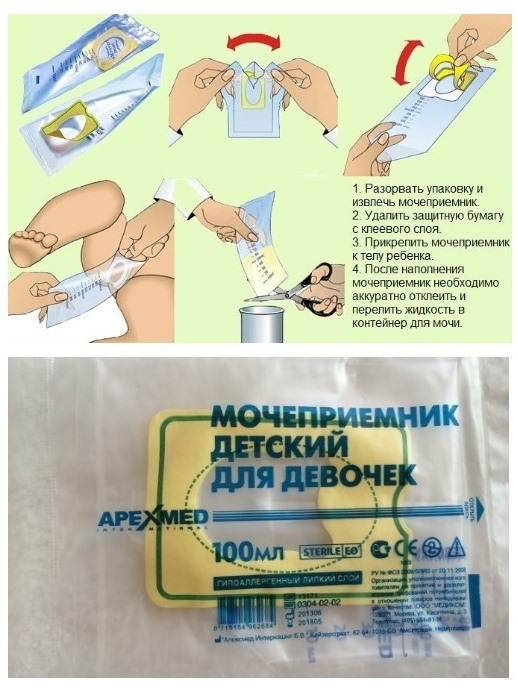 Как собрать мочу у грудничка мальчика и девочки