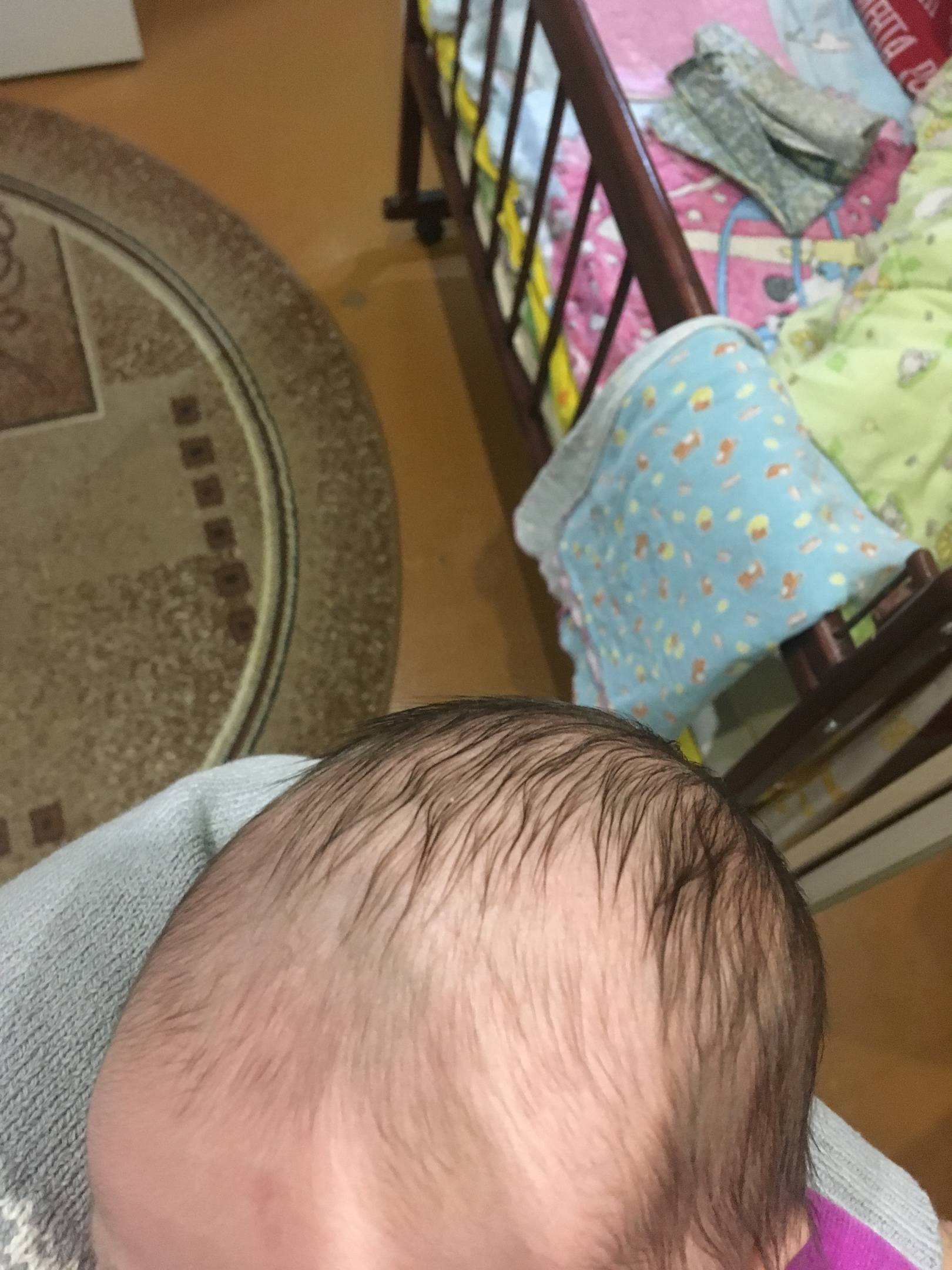 Выпадают волосы 4 месяц. Волосики на голове у младенца. У грудничка выпадают волосы. Волосы у новорожденных на голове. Младенец с волосами на голове.