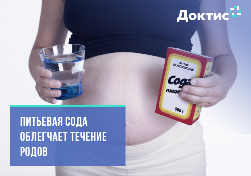 Сода от изжоги при беременности: можно ли ее пить?