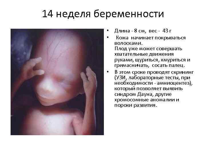 14 неделя беременности. календарь беременности   | материнство - беременность, роды, питание, воспитание