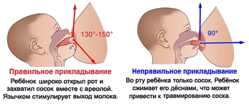 Если малыш часто плачет при кормлении грудью