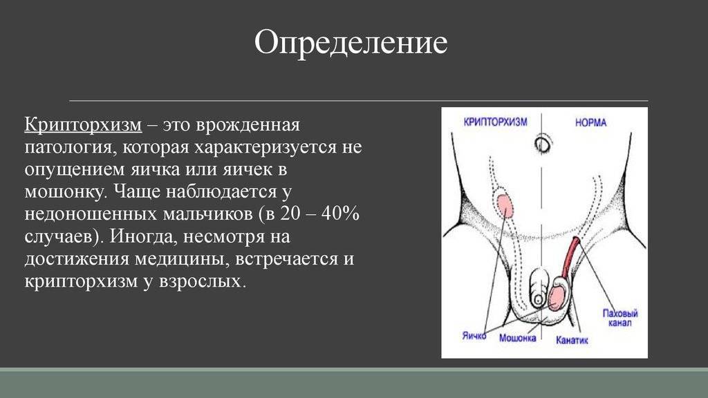 Нарушение строения мошонки у мальчиков
