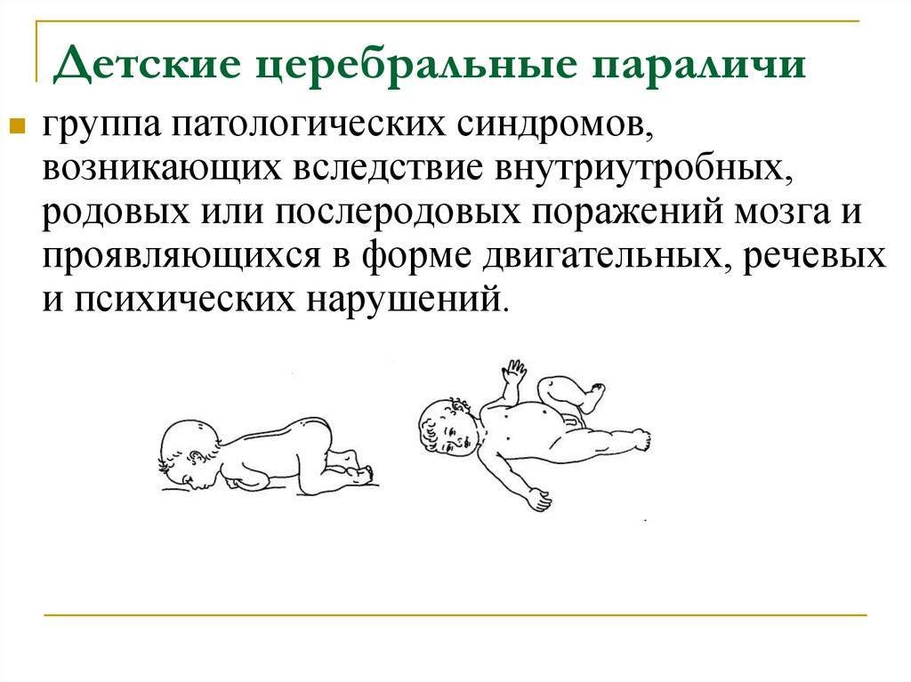 Дцп у новорожденных - симптомы, характерные для каждого периода | spravki1.ru