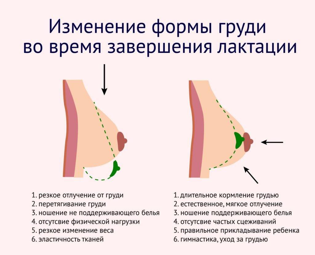 Грудь после родов, как подтянуть и восстановить форму груди после прекращения кормления, пластика сосков и коррекция