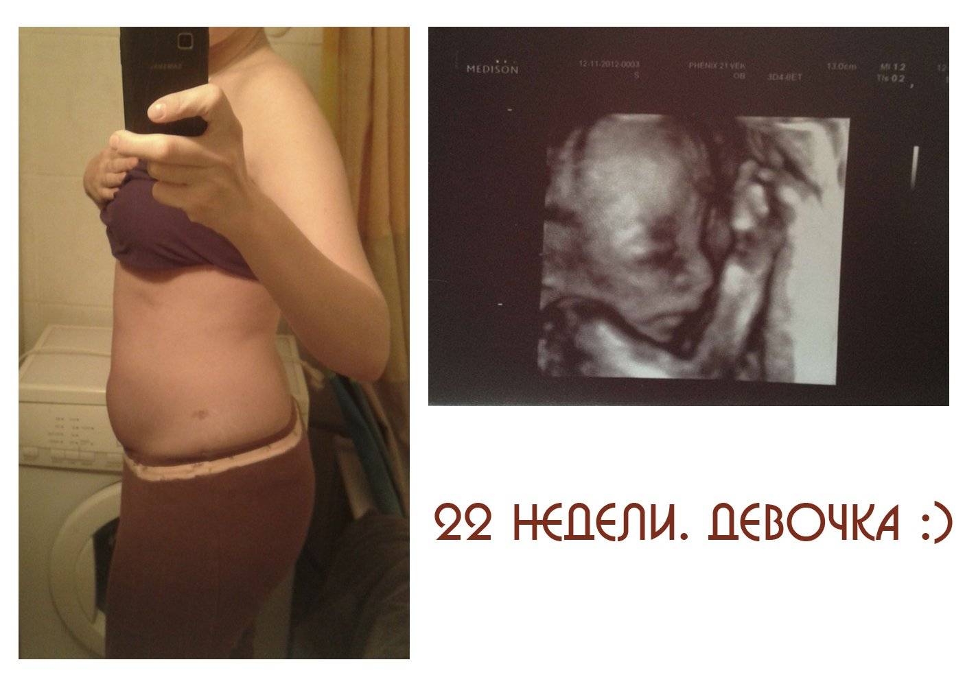 22 неделя беременности: что происходит, ощущения