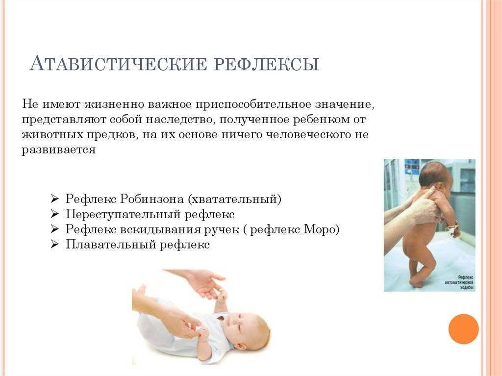 Безусловные рефлексы новорожденного