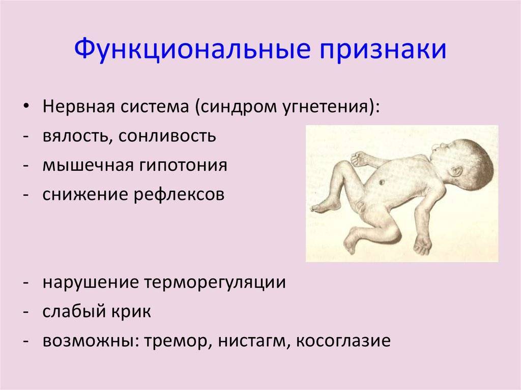 Гипотонус у грудничка: комаровский о пониженном напряжении мышц у младенцев, признаки и лечение
