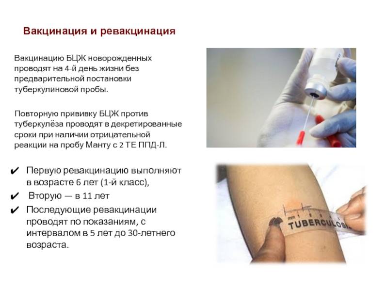 Прививка бцж у новорожденных: какая реакция и что делать если не делали в роддоме? | prof-medstail.ru