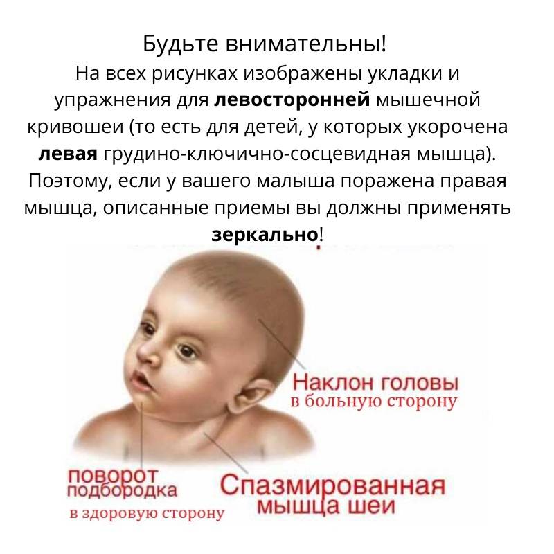 Почему ребенок 6-9 месяцев мотает и трясет головой из стороны в сторону?