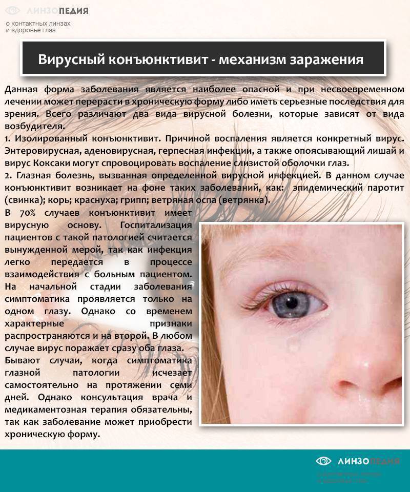 Быстрое лечение ячменя на глазу у детей - препараты, фото и комаровский
