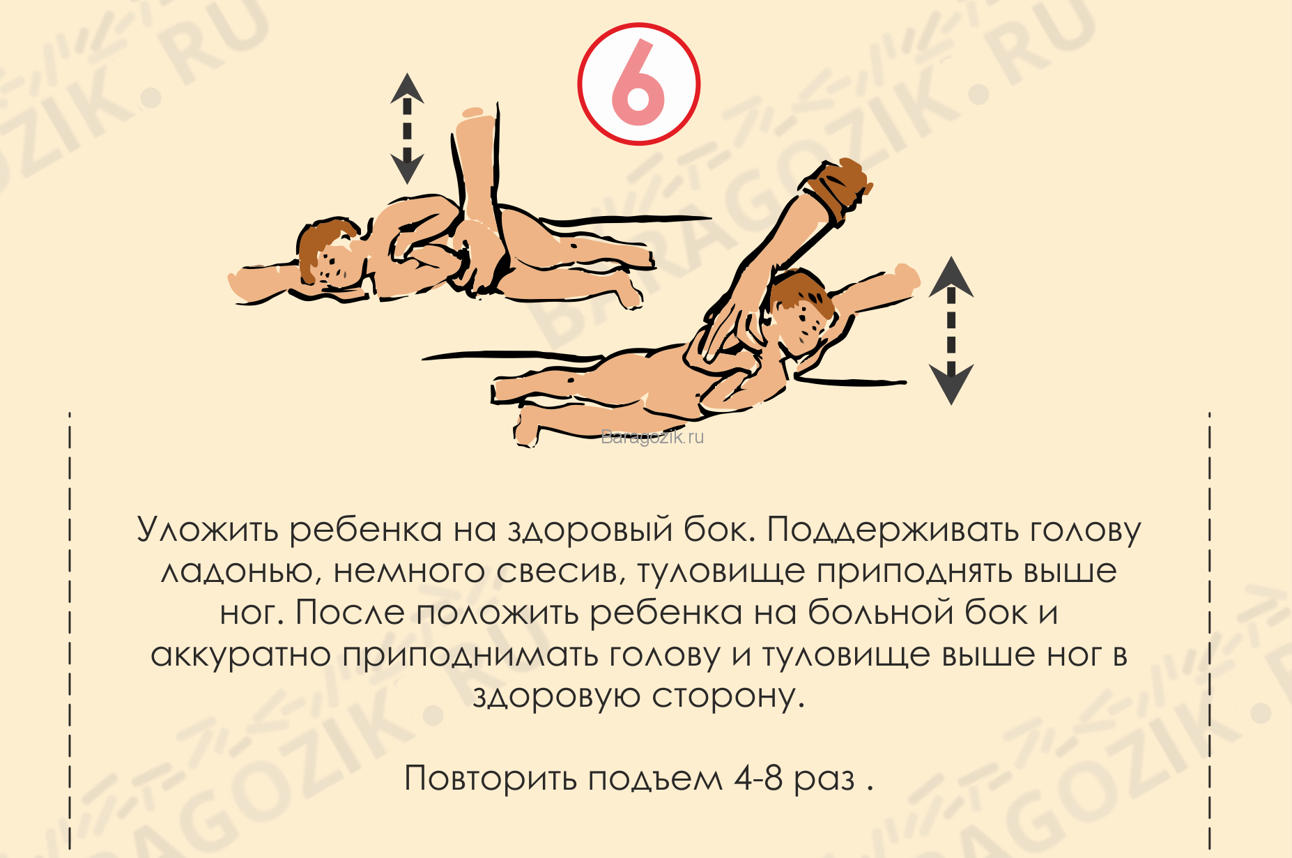 Кривошея у новорожденных: признаки, причины, лечение, массаж, фото