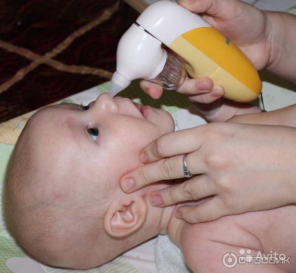 Как почистить носик новорождённому? советы от педиатра