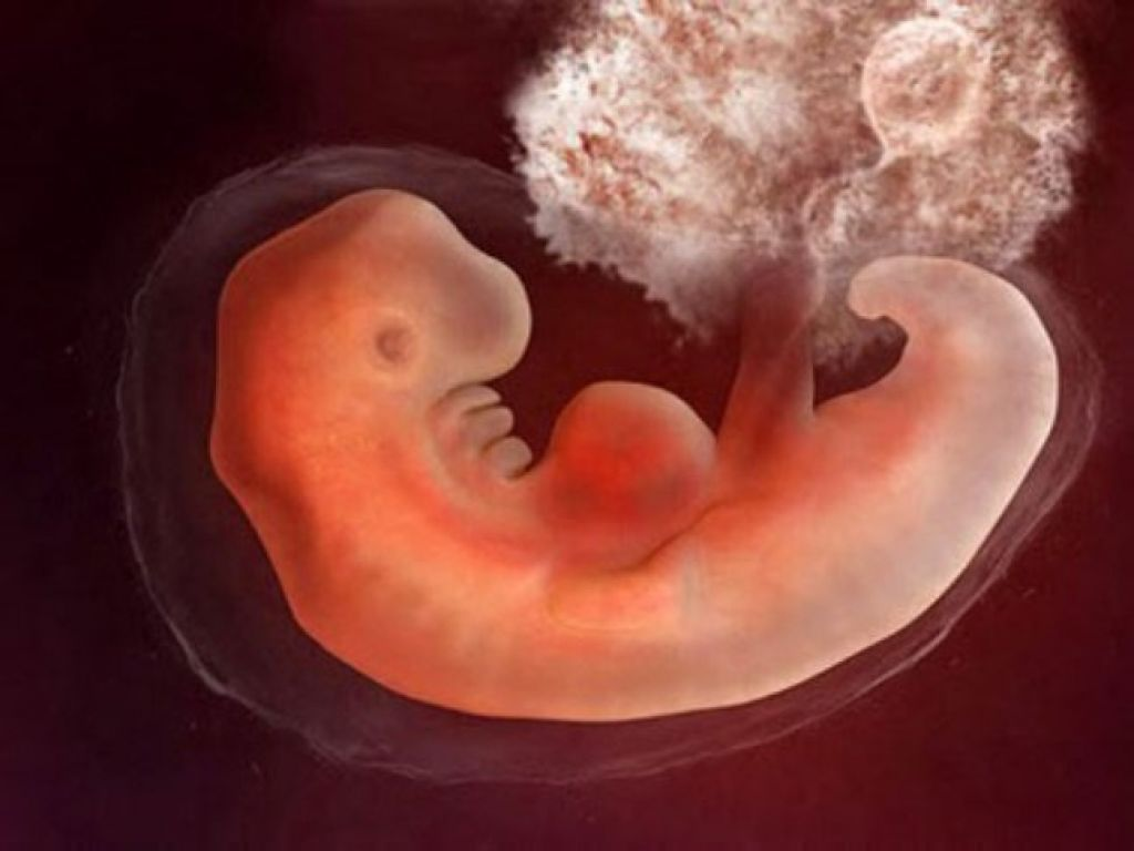 Эмбрион на какой неделе. Плод 3-4 недели беременности. Эмбрион на 5 неделе беременности. Эмбрион выглядит 4 недели. Как выглядит эмбрион в 4 недели.