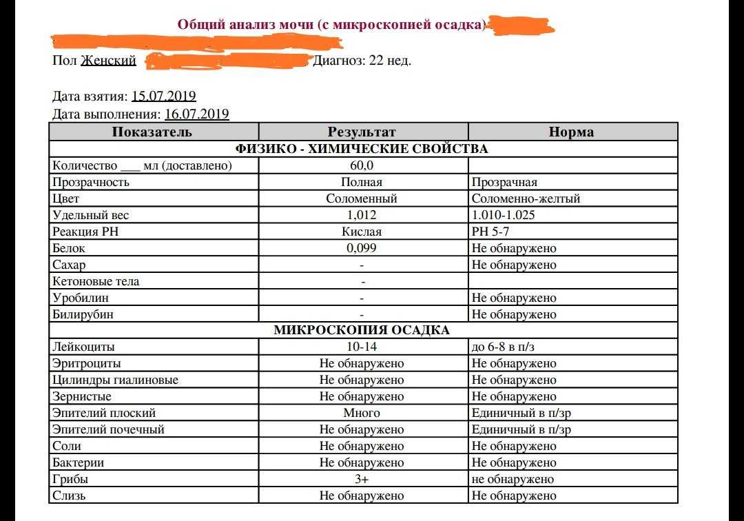 Присутствие слизи, солей и белка в анализах детской мочи: основания, симптомы