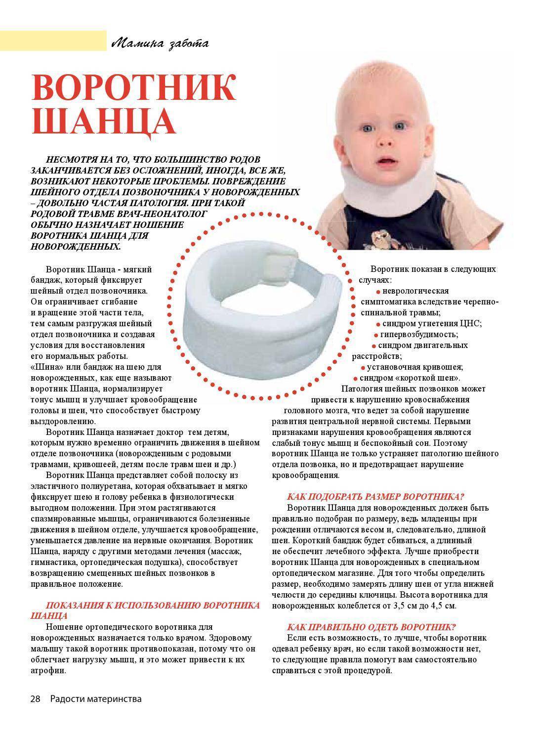 Воротник Шанца для новорожденных — как носить и сколько, размеры