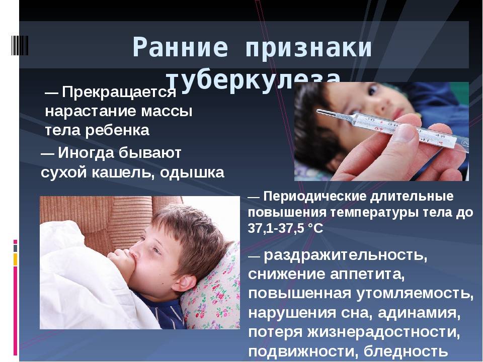 Признаки туберкулеза у детей: 4 ранних симптома, на которые важно обратить внимание