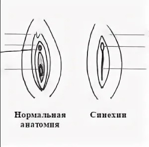 Дырки от представительниц женского пола